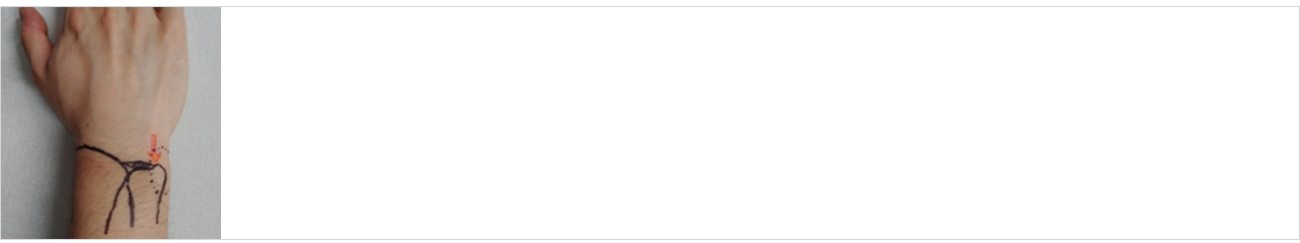 손발질환 안내 이미지 1