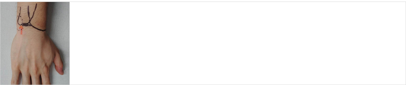 손발질환 안내 이미지 1