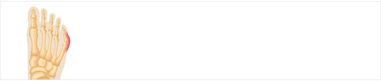 손발질환 안내 이미지 1