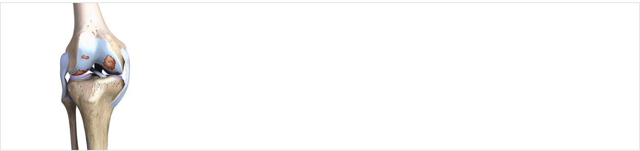 관절질환 안내 이미지 1