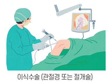 수술치료 안내 이미지 4